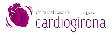 Electrocardiograma